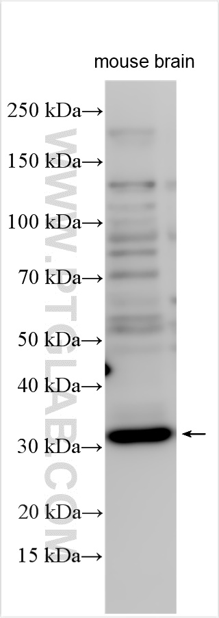 Western Blot (WB) analysis of various lysates using KCTD15 Polyclonal antibody (20128-1-AP)