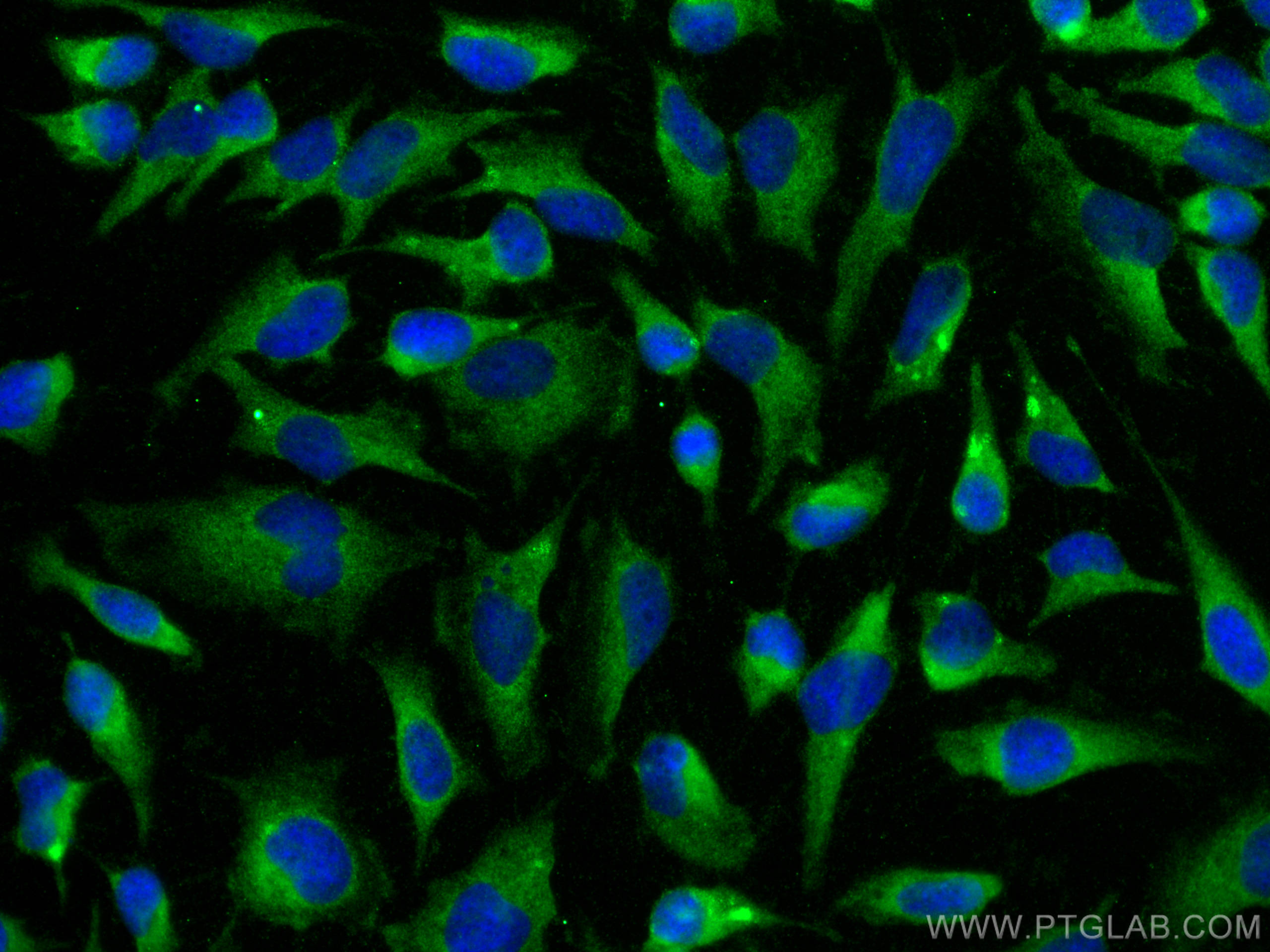 Immunofluorescence (IF) / fluorescent staining of HeLa cells using KCTD2/5/17 Polyclonal antibody (15553-1-AP)