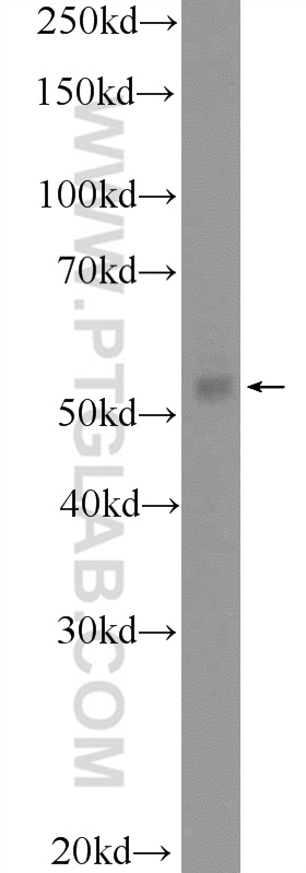 Western Blot (WB) analysis of HepG2 cells using KDELC1 Polyclonal antibody (17018-1-AP)