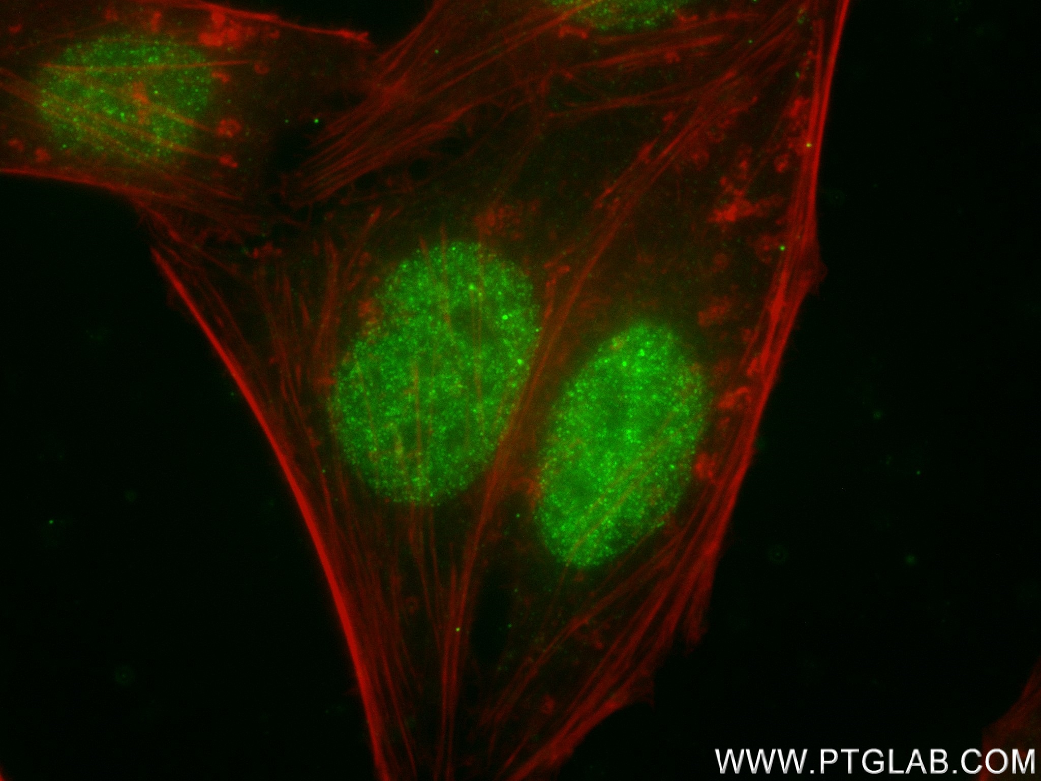 Immunofluorescence (IF) / fluorescent staining of HepG2 cells using KDM3A/JMJD1A Recombinant antibody (83571-2-RR)