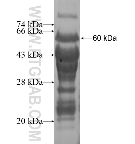 KDM3B fusion protein Ag13795 SDS-PAGE