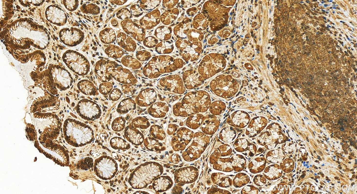 Immunohistochemistry (IHC) staining of human stomach tissue using RBP2 Polyclonal antibody (18825-1-AP)