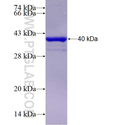 KDM5B fusion protein Ag28821 SDS-PAGE