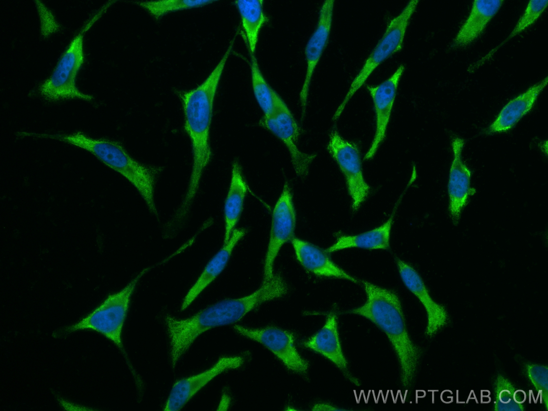 Immunofluorescence (IF) / fluorescent staining of HeLa cells using CoraLite® Plus 488-conjugated KEAP1 Monoclonal ant (CL488-60027)