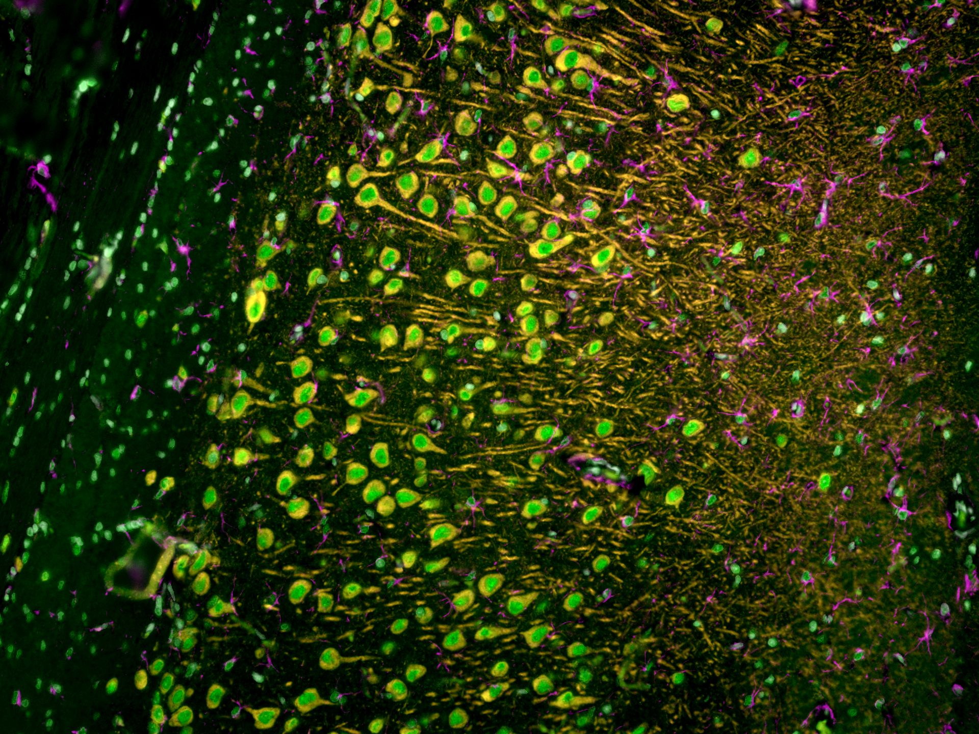 Immunofluorescence of rat brain tissue: FFPE rat brain tissue sections were stained with anti-MAP2 (17490-1-AP) labeled with FlexAble CoraLite® Plus 550 Kit (KFA002, orange), anti-GFAP (16825-1-AP) labeled with FlexAble CoraLite® Plus 650 Kit (KFA003, magenta) and CoraLite®488-conjugated TDP-43 antibody (CL488-10782, green).