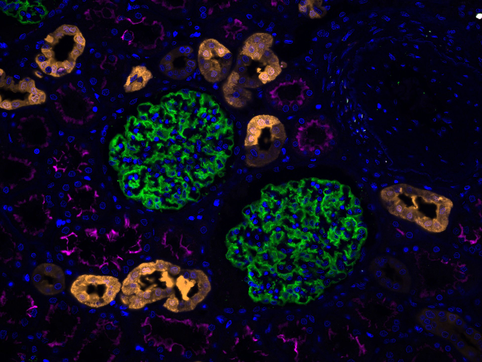 Immunofluorescence of human kidney: FFPE human kidney sections were stained with anti-Calbindin (14479-1-AP) labeled with FlexAble CoraLite® Plus 550 Kit (KFA002, yellow), anti-ACE2 (66699-1-Ig) labeled with FlexAble CoraLite® Plus 650 Kit (KFA023, magenta), CoraLite®488-conjugated Podocalyxin antibody (CL488-18150, green) and DAPI (blue).