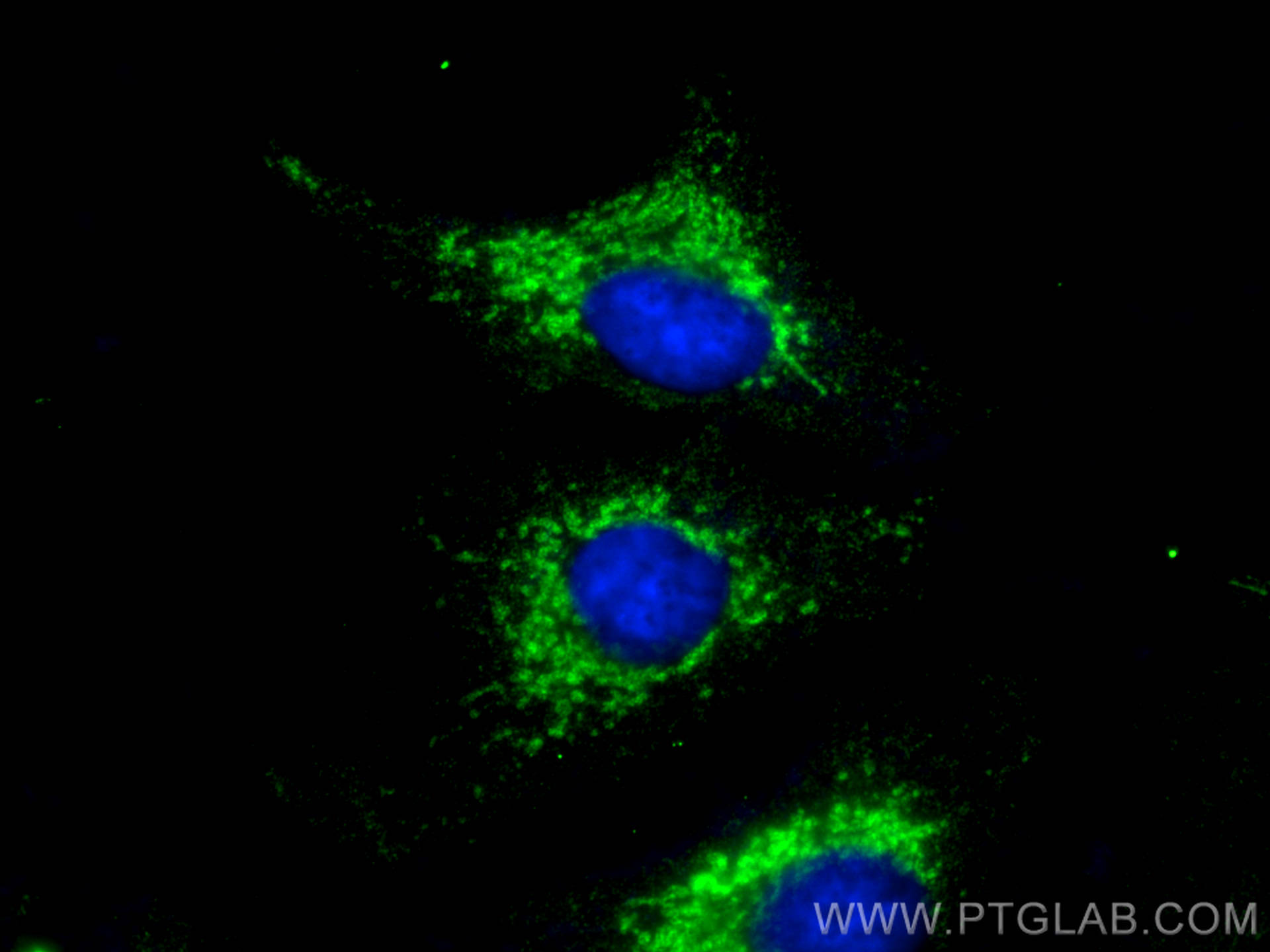 Immunofluorescence (IF) / fluorescent staining of A549 cells using KGA-Specific Monoclonal antibody (66265-2-Ig)