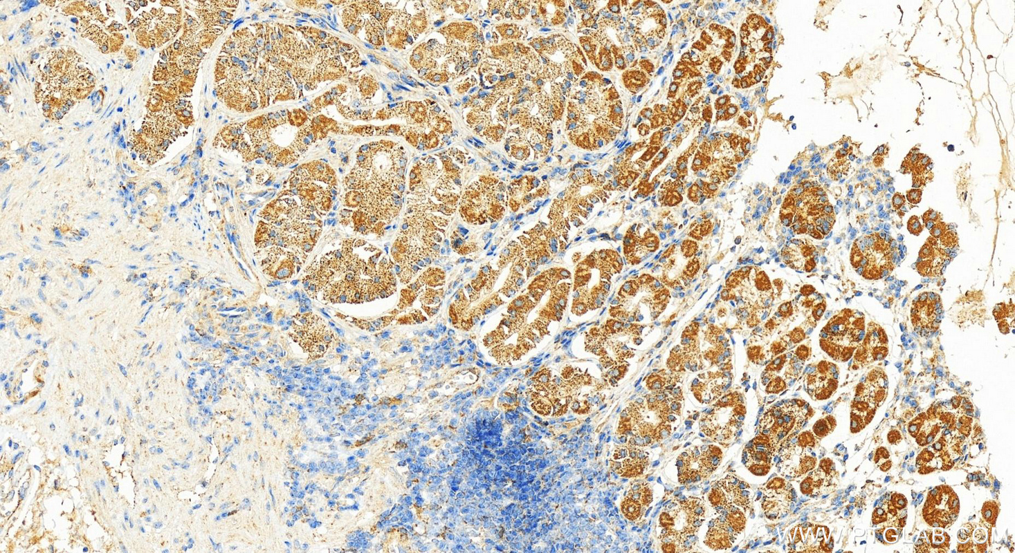 Immunohistochemistry (IHC) staining of human stomach tissue using KHDC1 Polyclonal antibody (23443-1-AP)