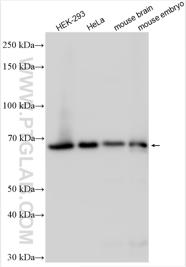 Western Blot (WB) analysis of various lysates using Sam68 Polyclonal antibody (10222-1-AP)