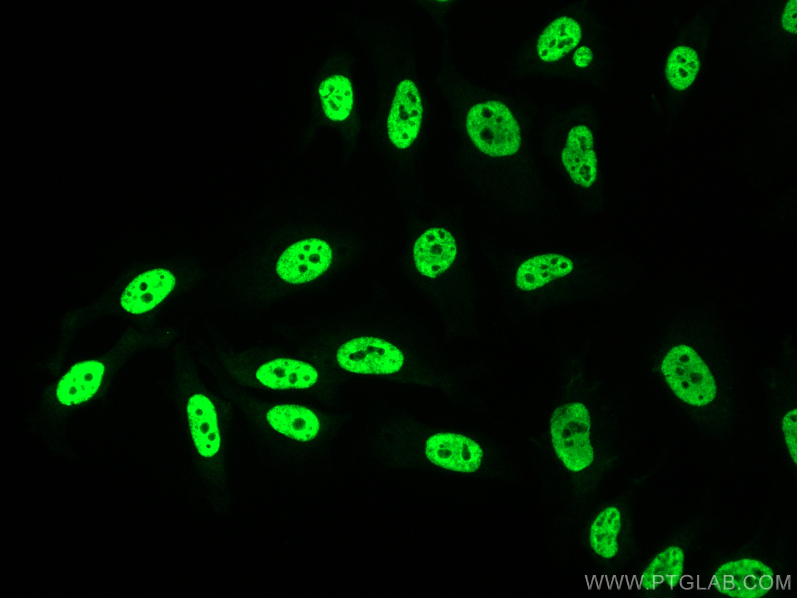 Immunofluorescence (IF) / fluorescent staining of HeLa cells using KHSRP Polyclonal antibody (31044-1-AP)