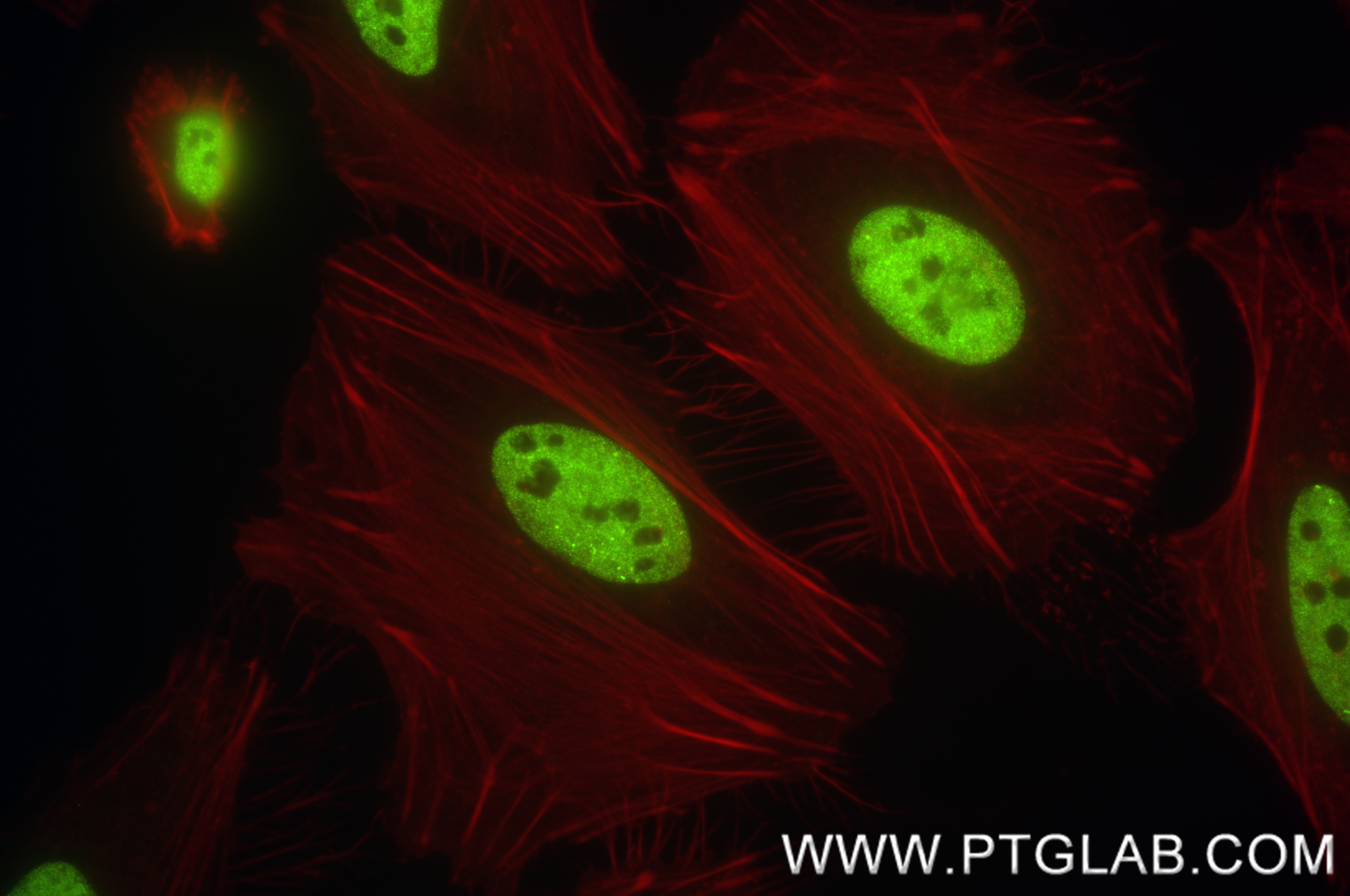 Immunofluorescence (IF) / fluorescent staining of HeLa cells using KHSRP Recombinant antibody (82931-1-RR)