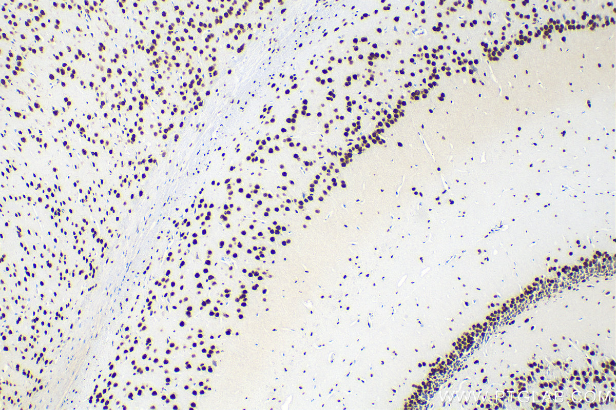 Immunohistochemistry (IHC) staining of mouse brain tissue using KHSRP Recombinant antibody (82931-1-RR)