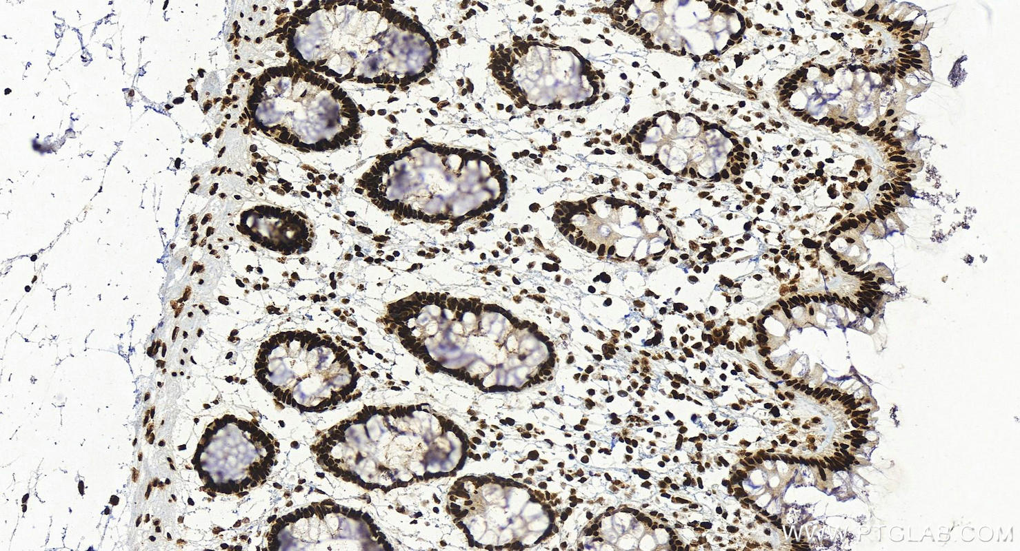 Immunohistochemistry (IHC) staining of human colon tissue using KHSRP Recombinant antibody (82931-3-RR)