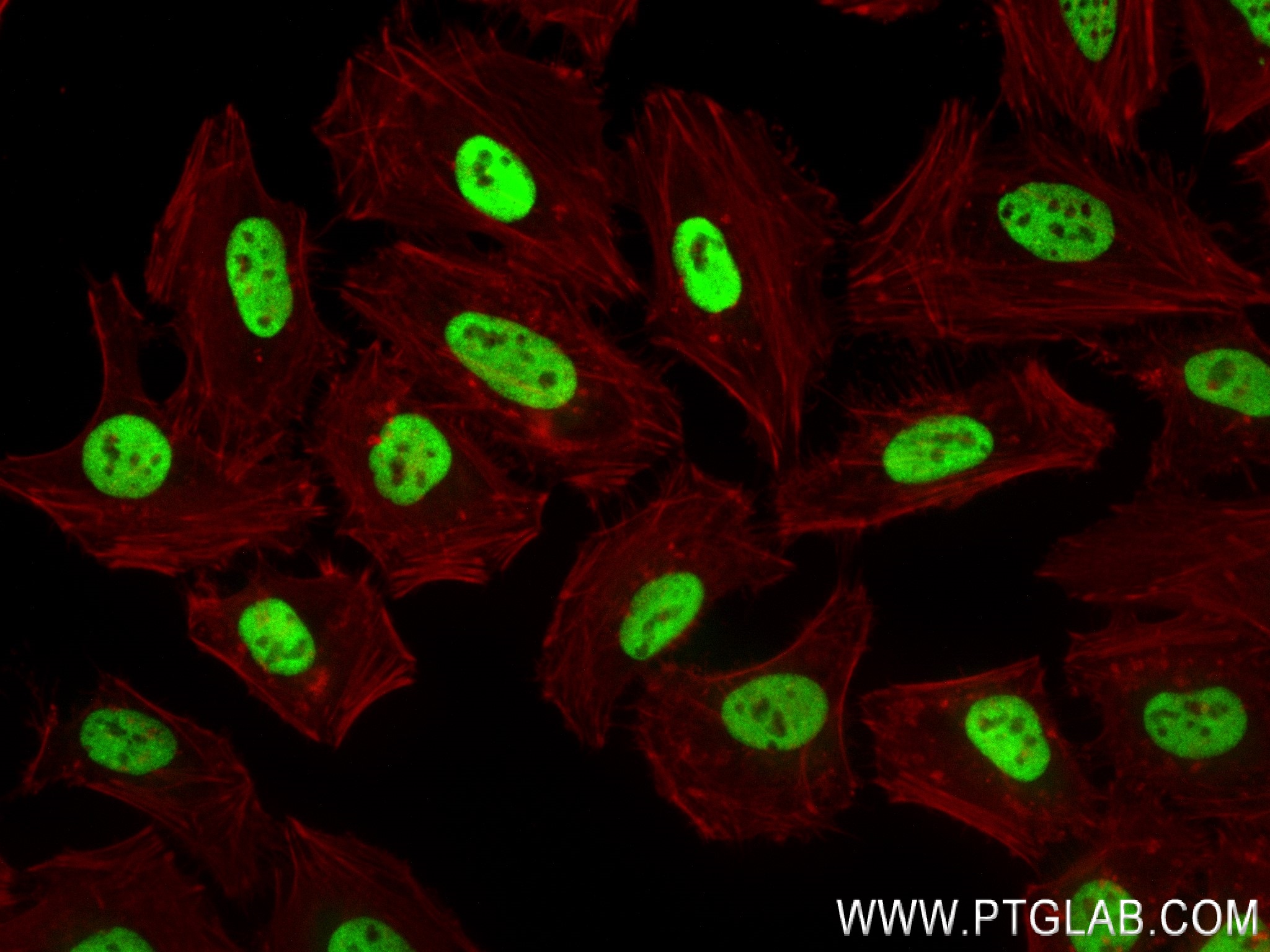 Immunofluorescence (IF) / fluorescent staining of HeLa cells using KHSRP Recombinant antibody (82931-3-RR)