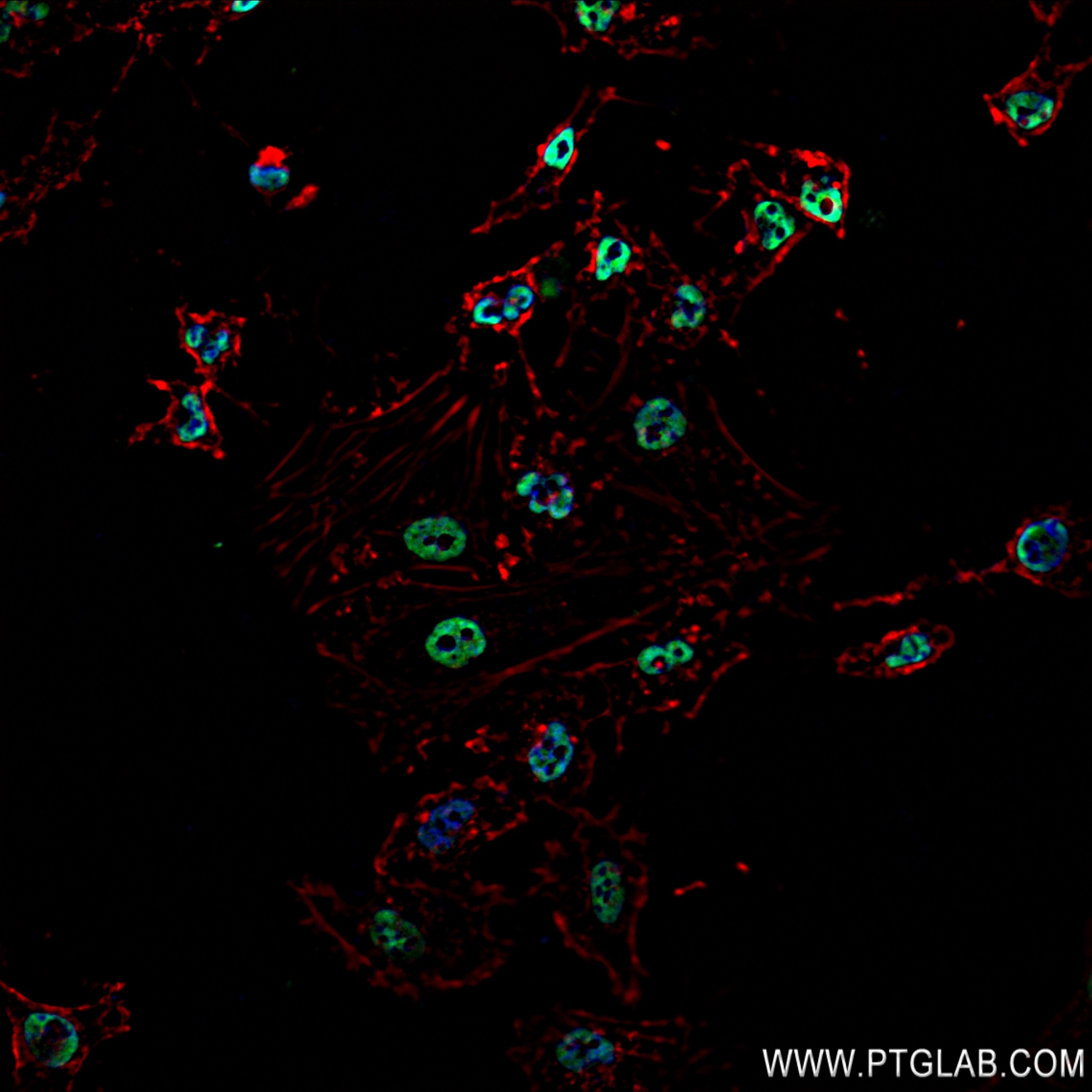 Immunofluorescence (IF) / fluorescent staining of HeLa cells using KHSRP Recombinant antibody (82931-5-RR)