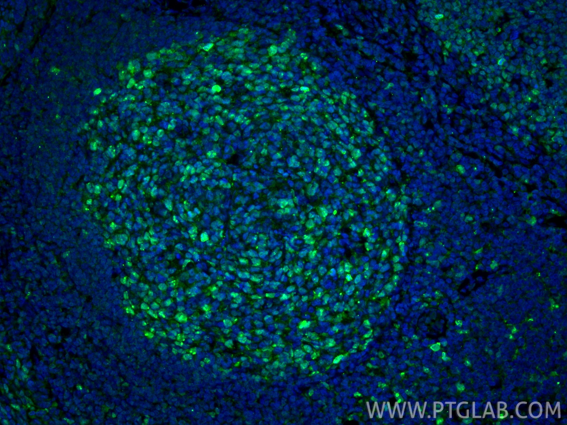 Immunofluorescence (IF) / fluorescent staining of human tonsillitis tissue using Ki-67 Polyclonal antibody (27309-1-AP)