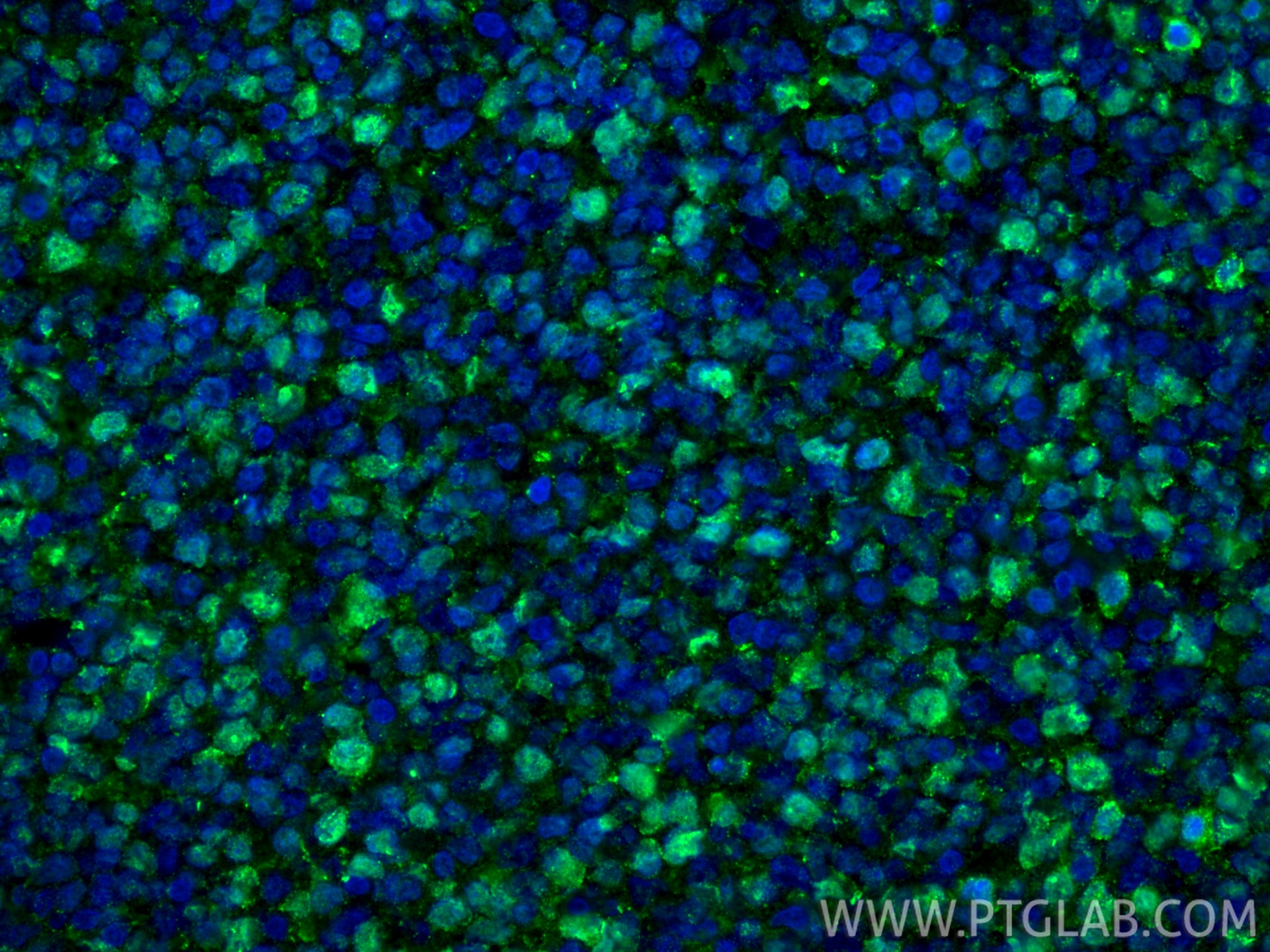 Immunofluorescence (IF) / fluorescent staining of human tonsillitis tissue using Ki-67 Polyclonal antibody (27309-1-AP)