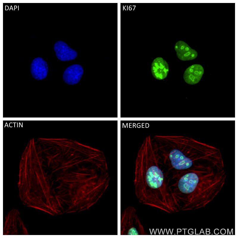 Immunofluorescence (IF) / fluorescent staining of U2OS cells using KI67 Recombinant antibody (84192-3-RR)