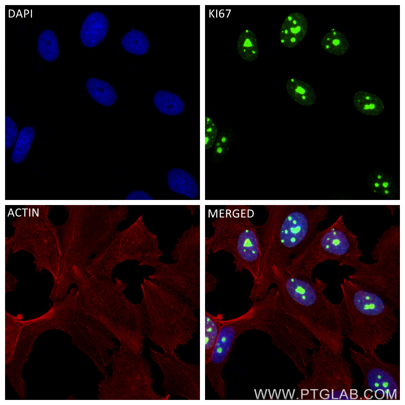 Immunofluorescence (IF) / fluorescent staining of MCF-7 cells using KI67 Recombinant antibody (84192-3-RR)