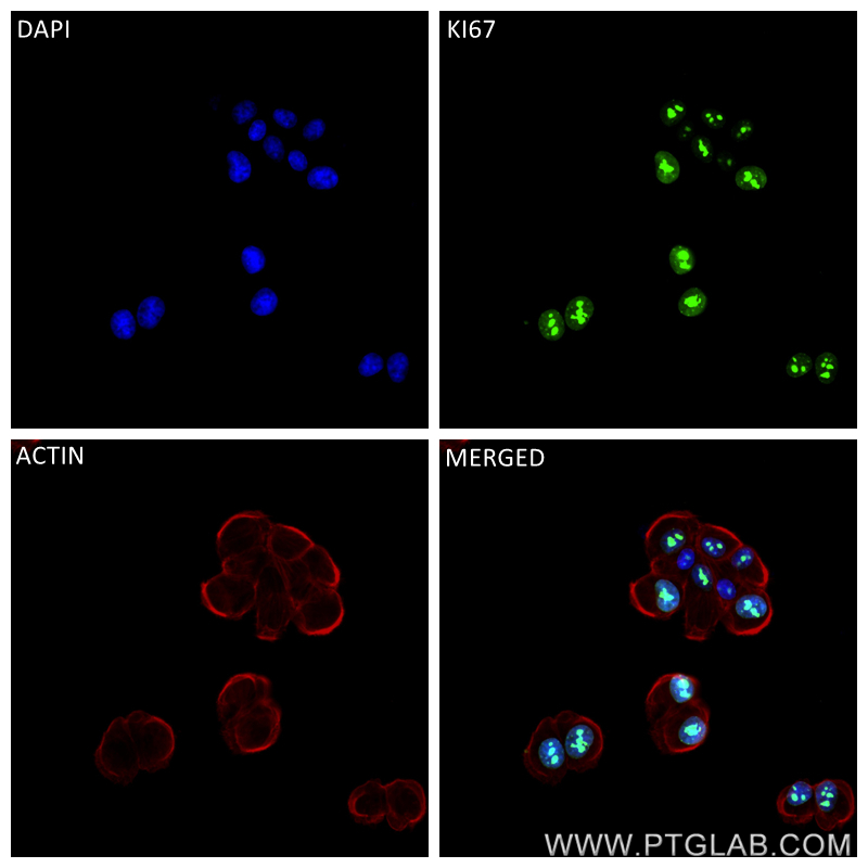 Immunofluorescence (IF) / fluorescent staining of hTERT-RPE1 cells using KI67 Recombinant antibody (84192-3-RR)