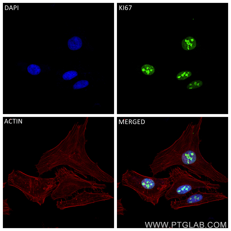 Immunofluorescence (IF) / fluorescent staining of HeLa cells using KI67 Recombinant antibody (84192-3-RR)