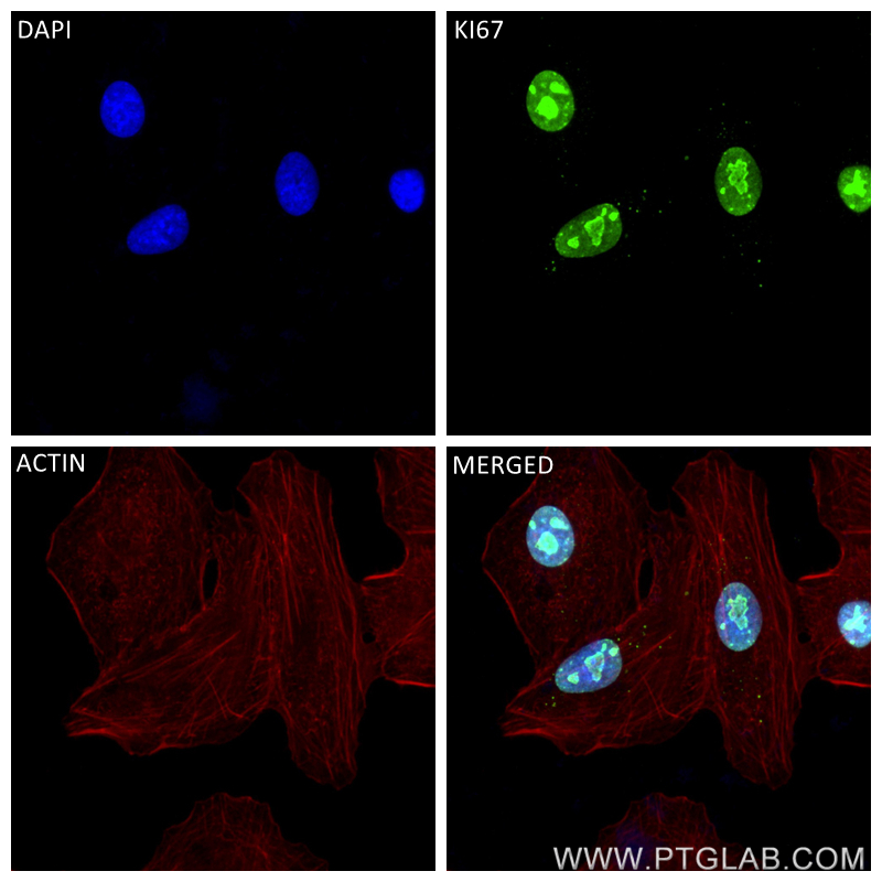 Immunofluorescence (IF) / fluorescent staining of A549 cells using KI67 Recombinant antibody (84192-3-RR)