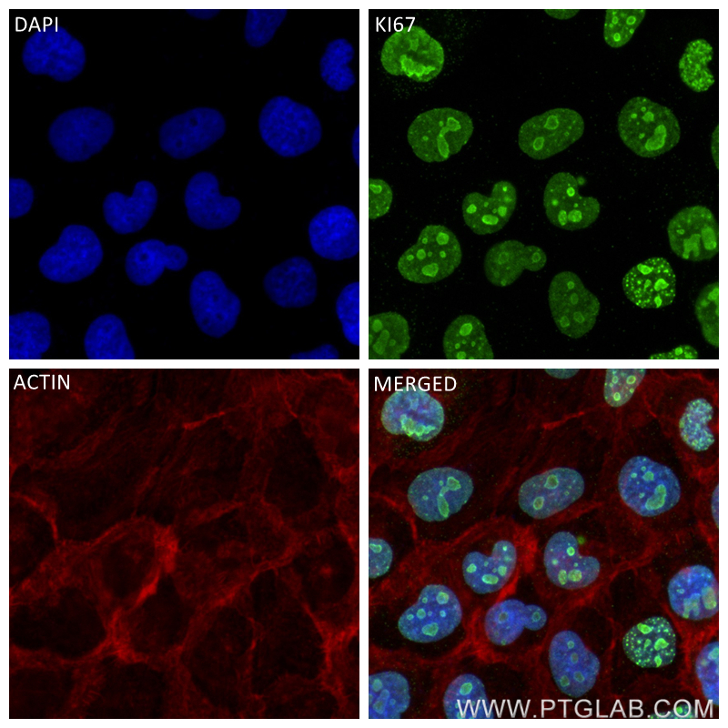 Immunofluorescence (IF) / fluorescent staining of A431 cells using KI67 Recombinant antibody (84192-3-RR)