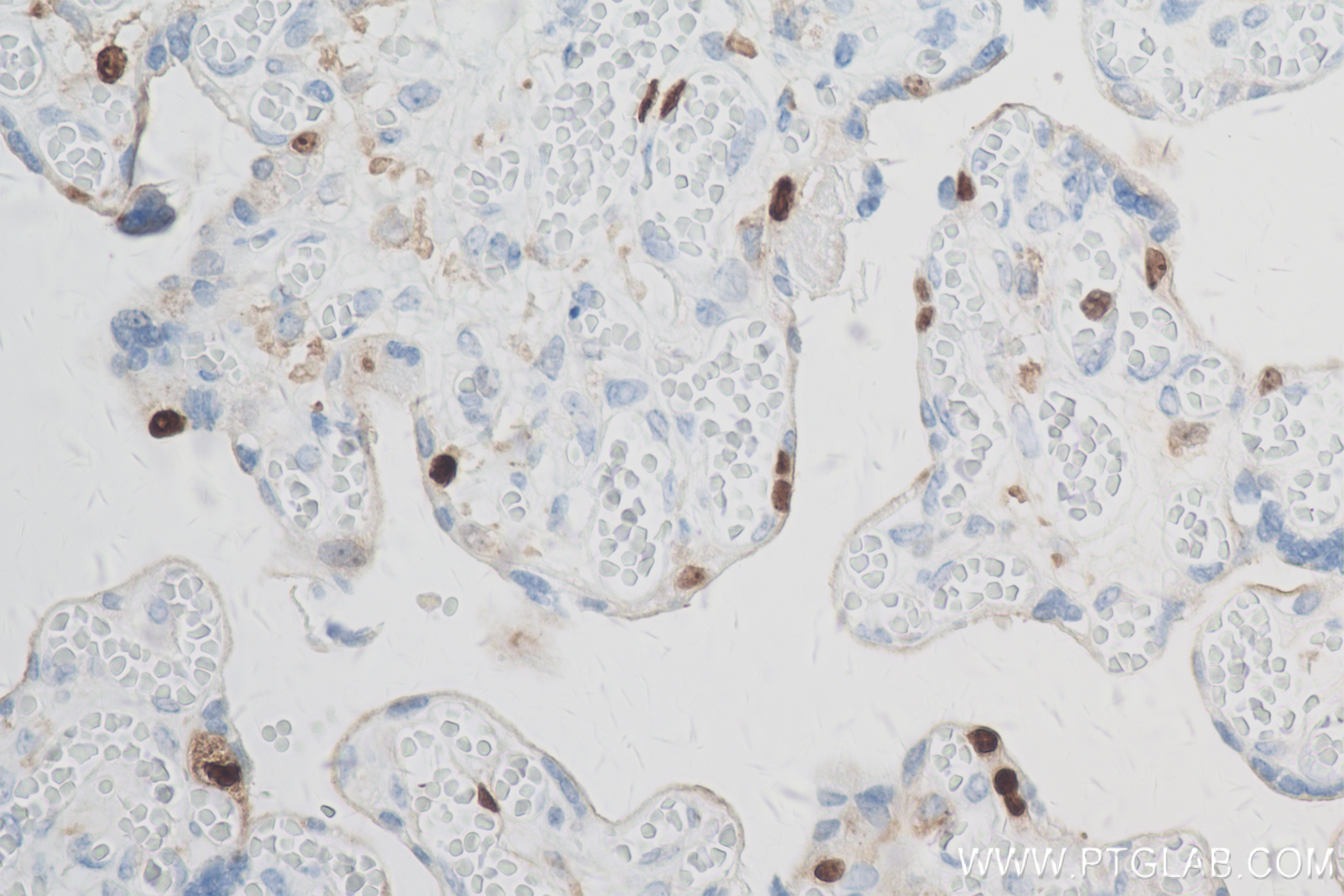 Immunohistochemistry (IHC) staining of human placenta tissue using KI67 Recombinant antibody (84192-3-RR)