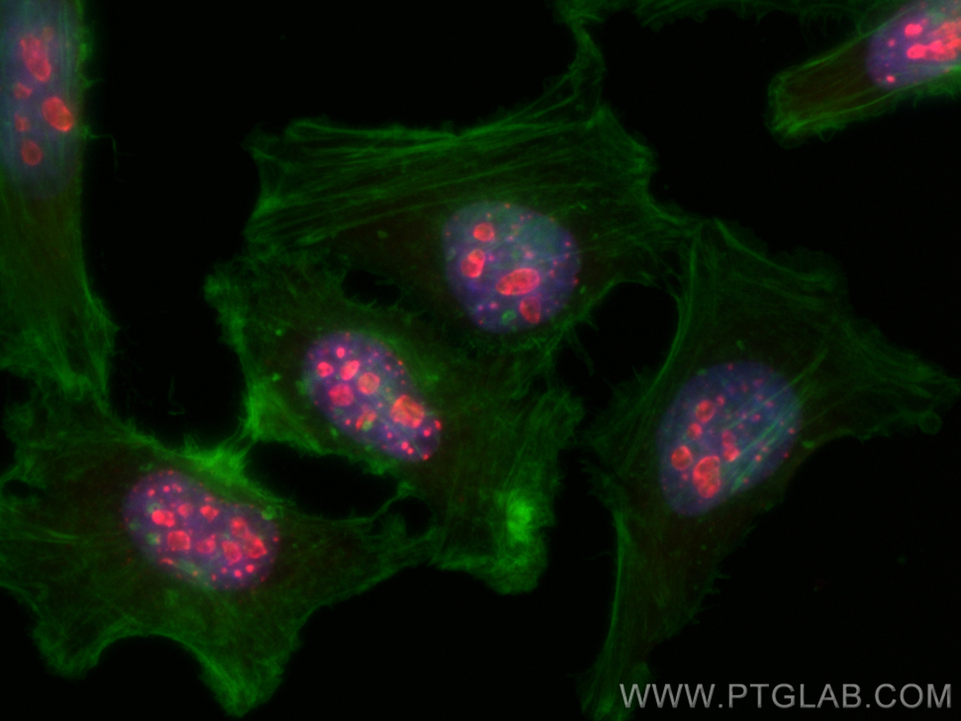 Immunofluorescence (IF) / fluorescent staining of HeLa cells using CoraLite®594-conjugated Ki-67 Polyclonal antibody (CL594-27309)