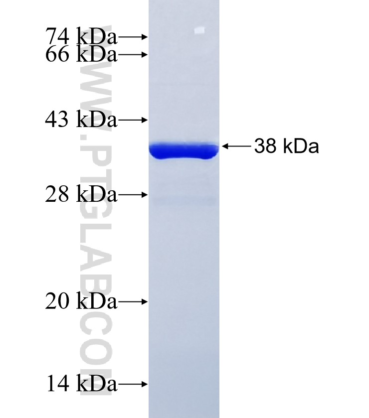KIAA0101 fusion protein Ag34887 SDS-PAGE