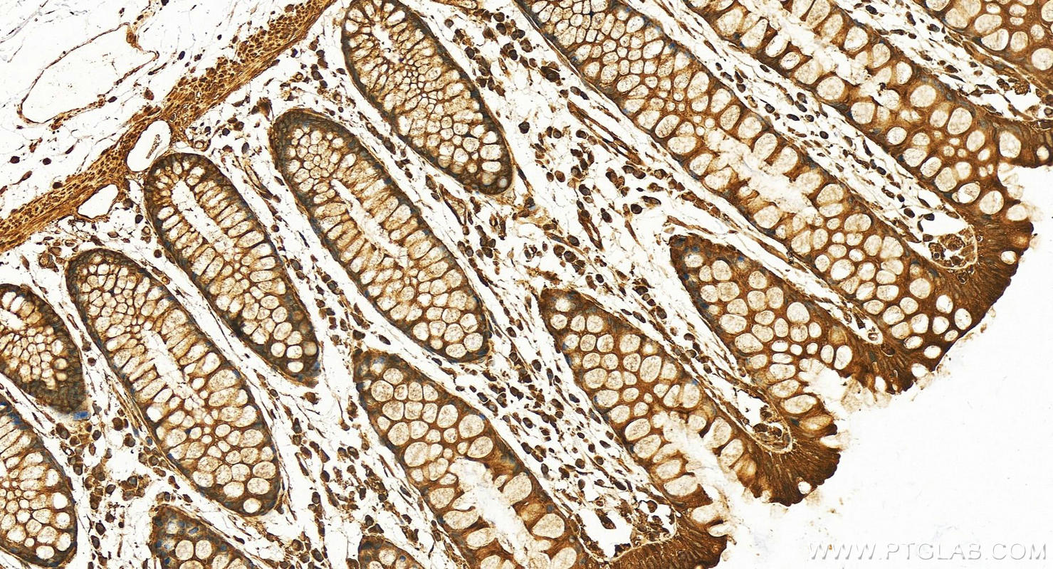 Immunohistochemistry (IHC) staining of human normal colon using DYNC1H1 Polyclonal antibody (12345-1-AP)