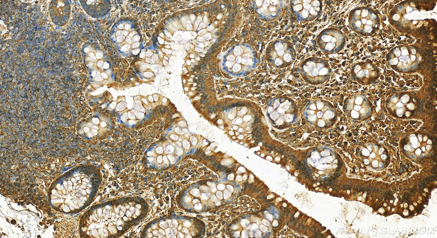 Immunohistochemistry (IHC) staining of human colon tissue using DYNC1H1 Polyclonal antibody (12345-1-AP)