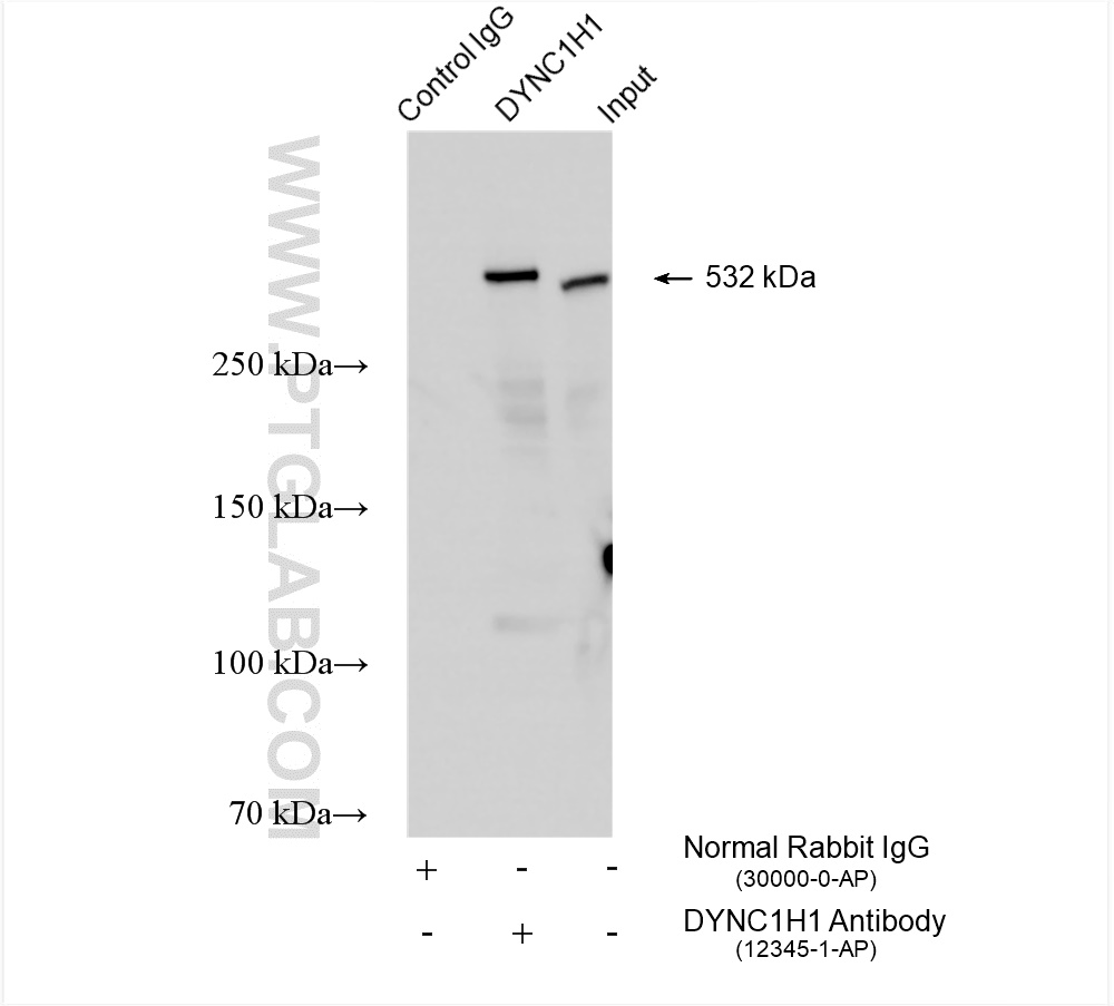 Immunoprecipitation (IP) experiment of HeLa cells using DYNC1H1 Polyclonal antibody (12345-1-AP)