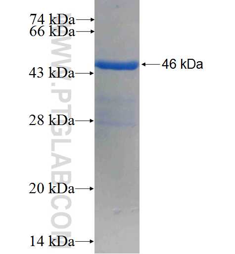 KIAA0495 fusion protein Ag23200 SDS-PAGE