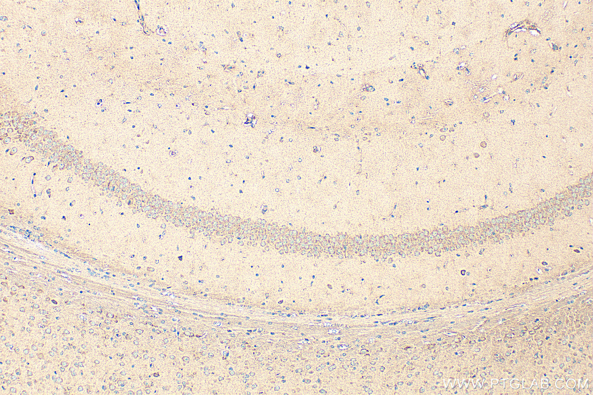 Immunohistochemistry (IHC) staining of mouse brain tissue using TALPID3 Polyclonal antibody (24421-1-AP)