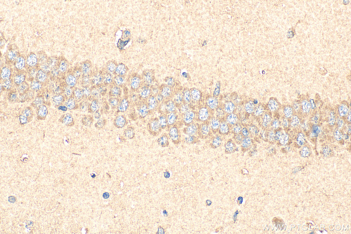 Immunohistochemistry (IHC) staining of mouse brain tissue using TALPID3 Polyclonal antibody (24421-1-AP)