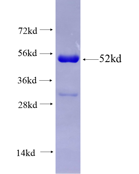 KIAA0649 fusion protein Ag27353 SDS-PAGE