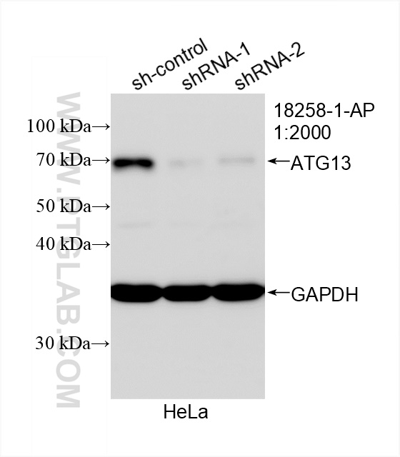 Western Blot (WB) analysis of HeLa cells using ATG13 Polyclonal antibody (18258-1-AP)