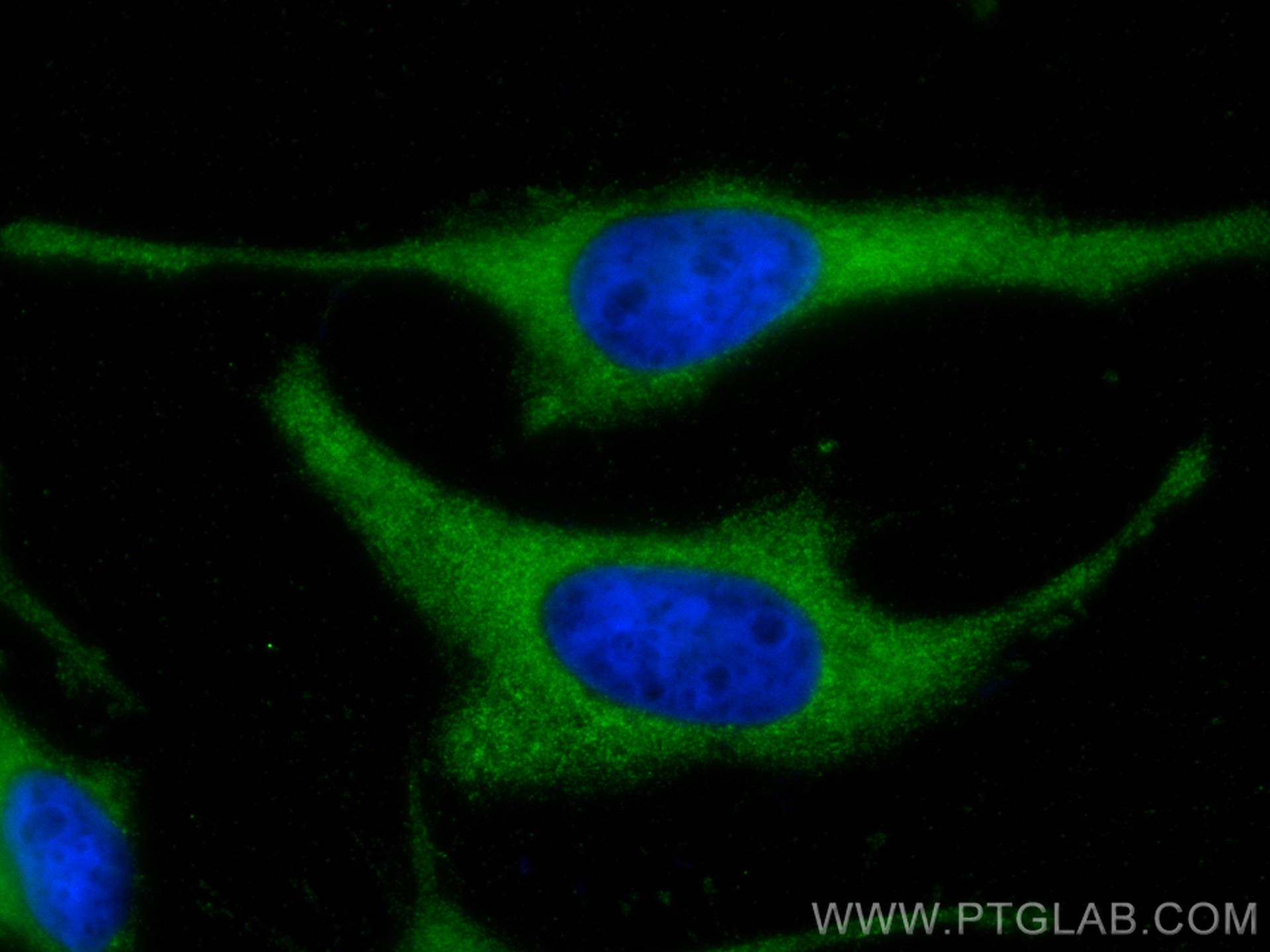 Immunofluorescence (IF) / fluorescent staining of HeLa cells using ATG13 Monoclonal antibody (66708-1-Ig)