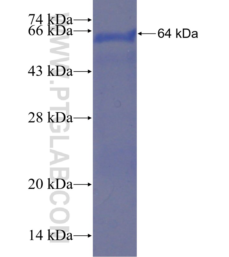 KIAA0776 fusion protein Ag23362 SDS-PAGE