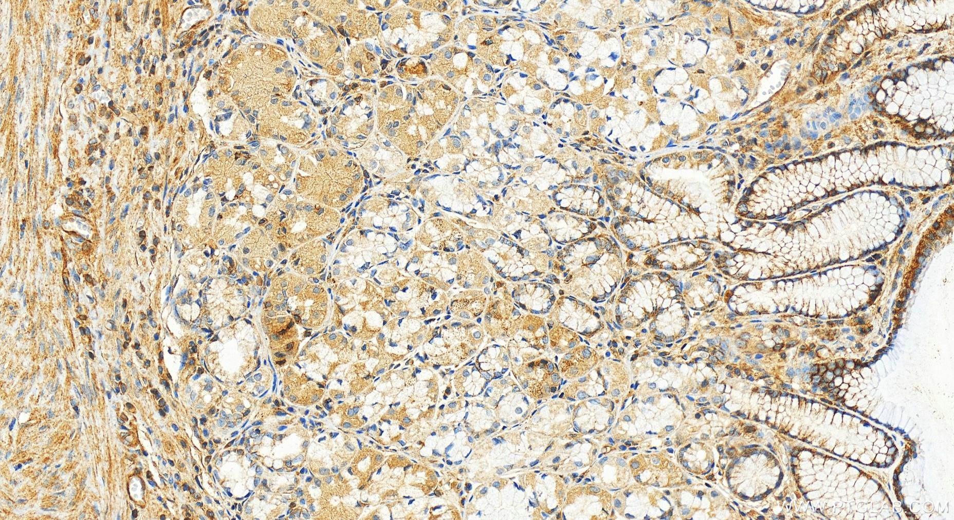 Immunohistochemistry (IHC) staining of human stomach tissue using KIAA1191 Polyclonal antibody (20637-1-AP)