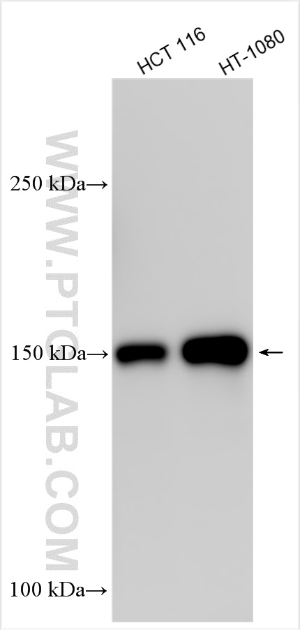 Western Blot (WB) analysis of various lysates using KIAA1199 / CEMIP  Polyclonal antibody (31106-1-AP)