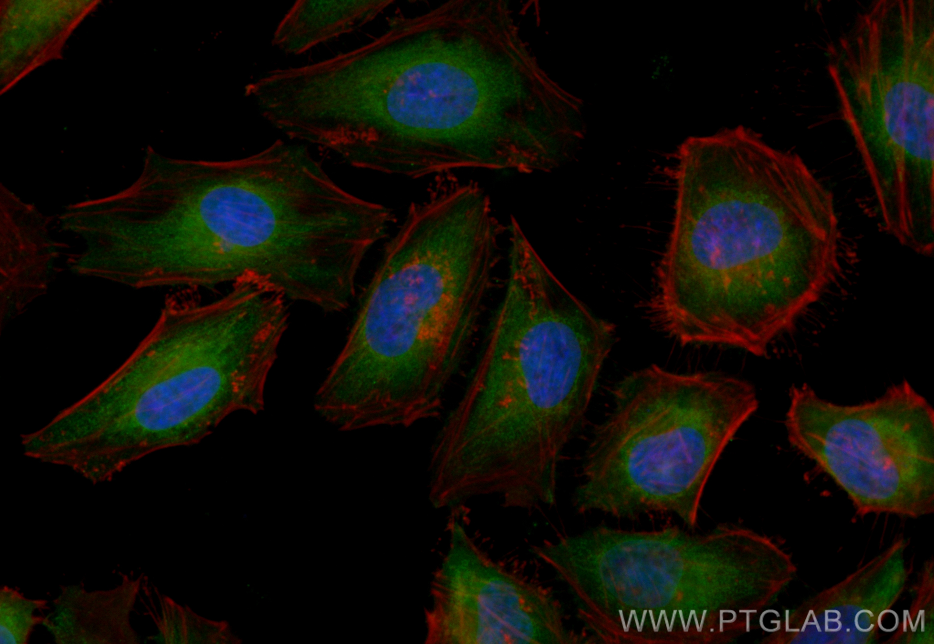 Immunofluorescence (IF) / fluorescent staining of HeLa cells using CoraLite® Plus 488-conjugated KIAA1199 / CEMIP  Po (CL488-21129)