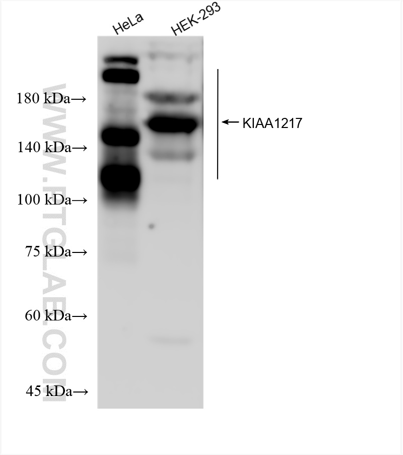 Western Blot (WB) analysis of various lysates using KIAA1217 Recombinant antibody (83361-2-RR)