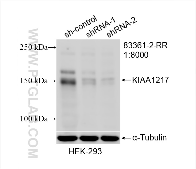 Western Blot (WB) analysis of HEK-293 cells using KIAA1217 Recombinant antibody (83361-2-RR)