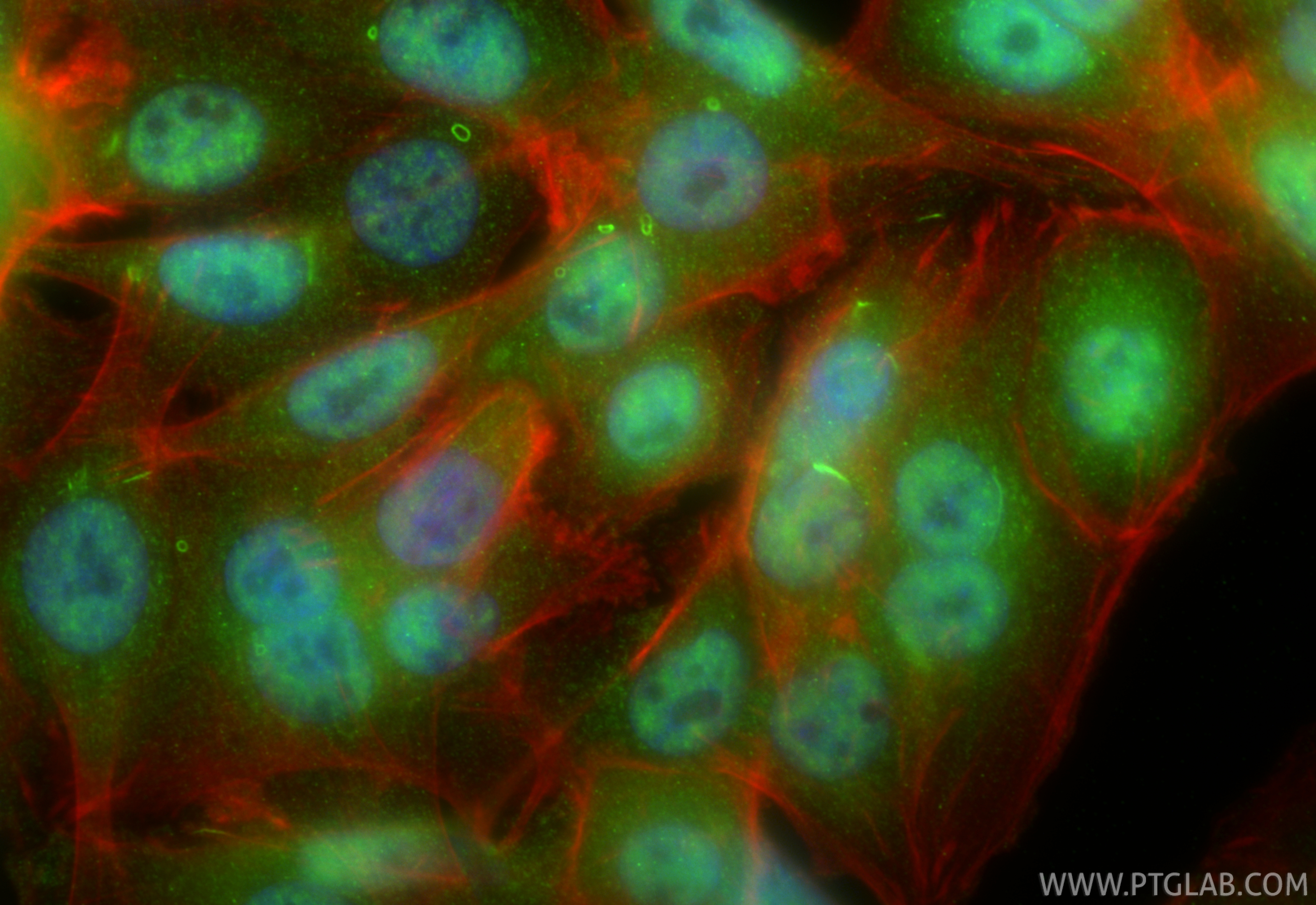 Immunofluorescence (IF) / fluorescent staining of SW480 cells using VIRMA/KIAA1429 Polyclonal antibody (25712-1-AP)