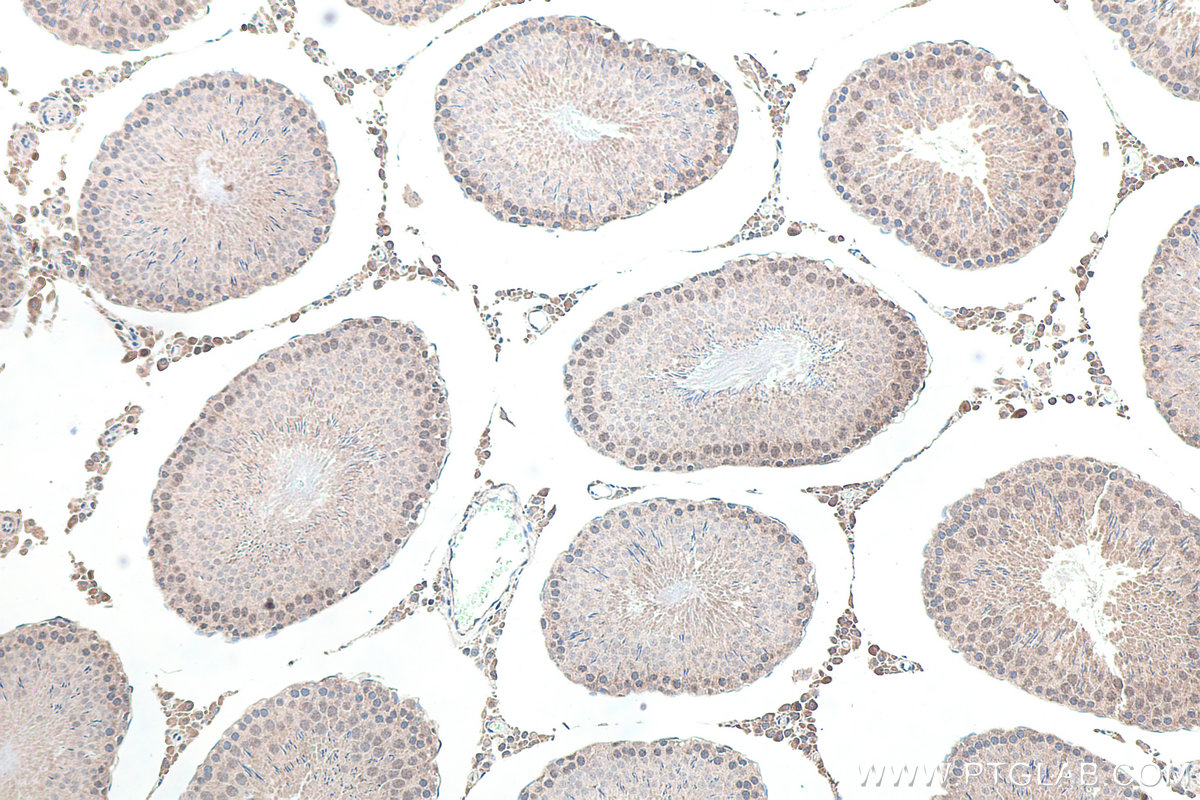Immunohistochemistry (IHC) staining of rat testis tissue using VIRMA/KIAA1429 Polyclonal antibody (25712-1-AP)