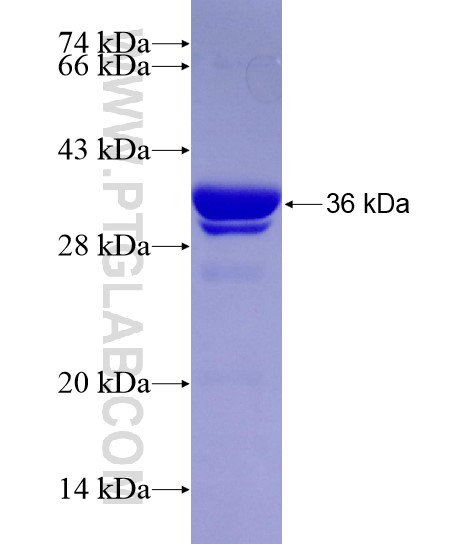 KIAA1462 fusion protein Ag28505 SDS-PAGE