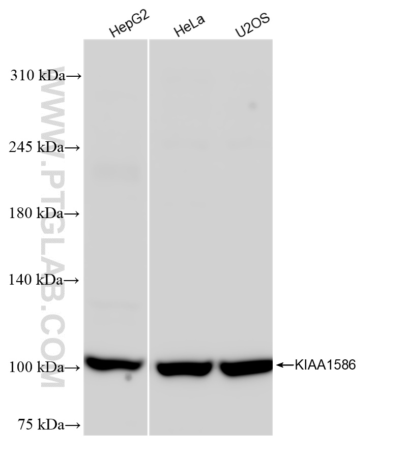 Western Blot (WB) analysis of various lysates using KIAA1586 Recombinant antibody (83900-7-RR)