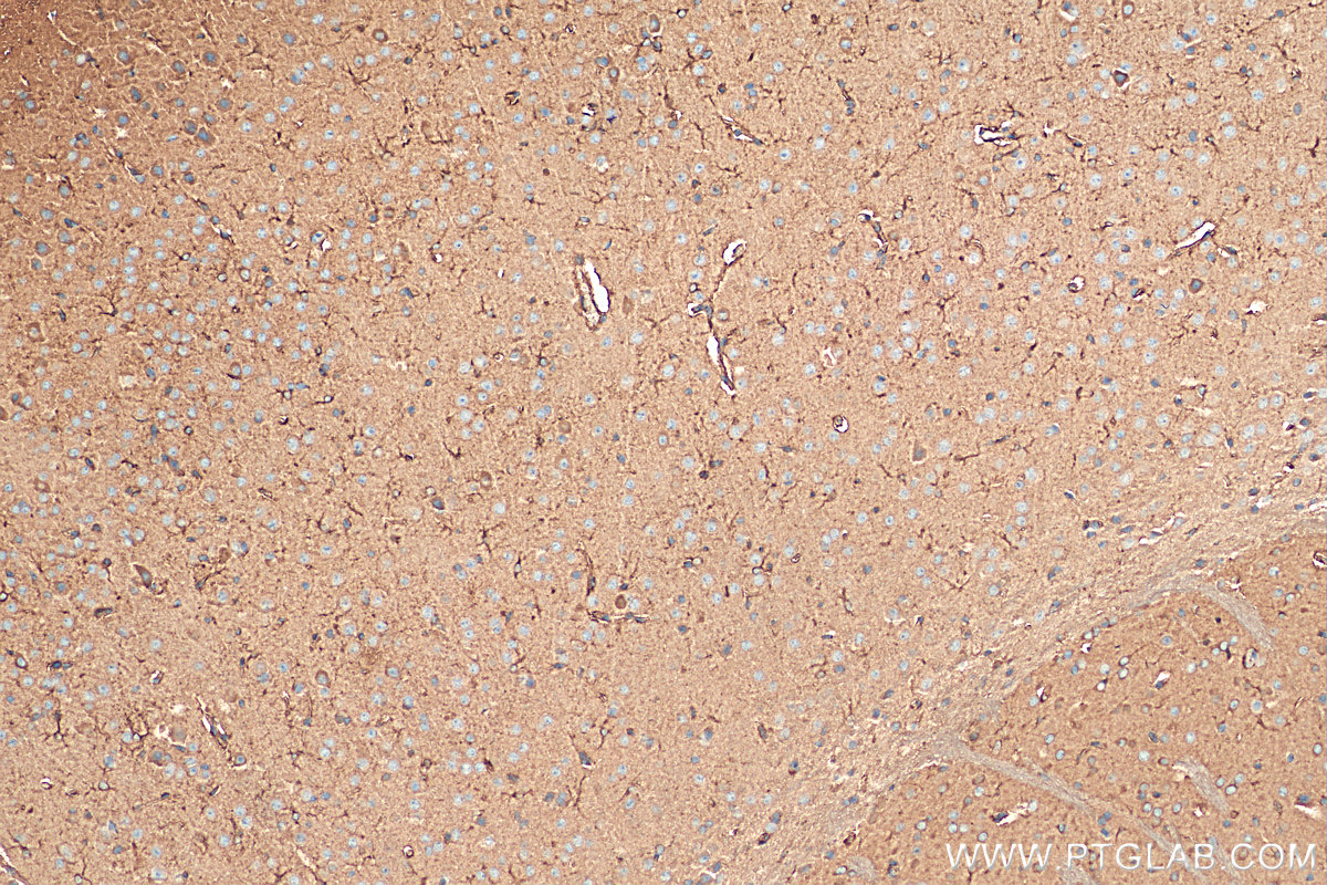 Immunohistochemistry (IHC) staining of mouse brain tissue using CEP44 Polyclonal antibody (24457-1-AP)